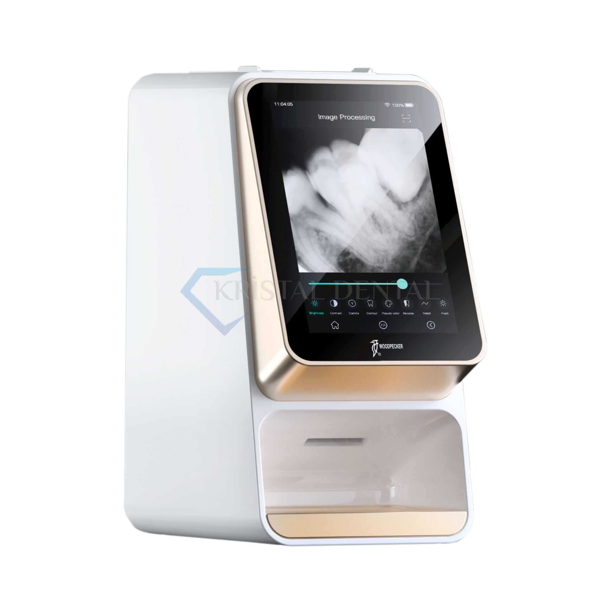 Woodpecker I-Scan Fosfor Plak Tarayıcı