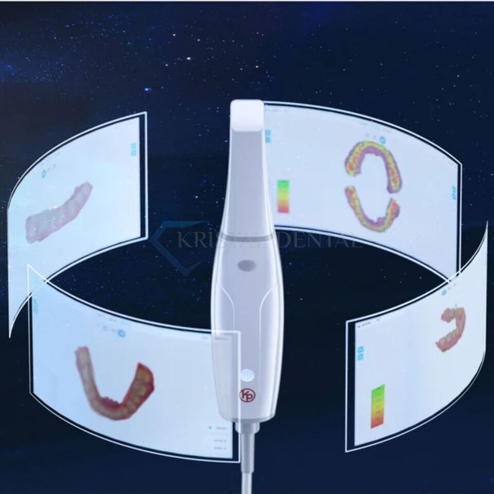 Woodpecker Smile Scan Intraoral - Ağız İçi Tarayıcı Cihazı