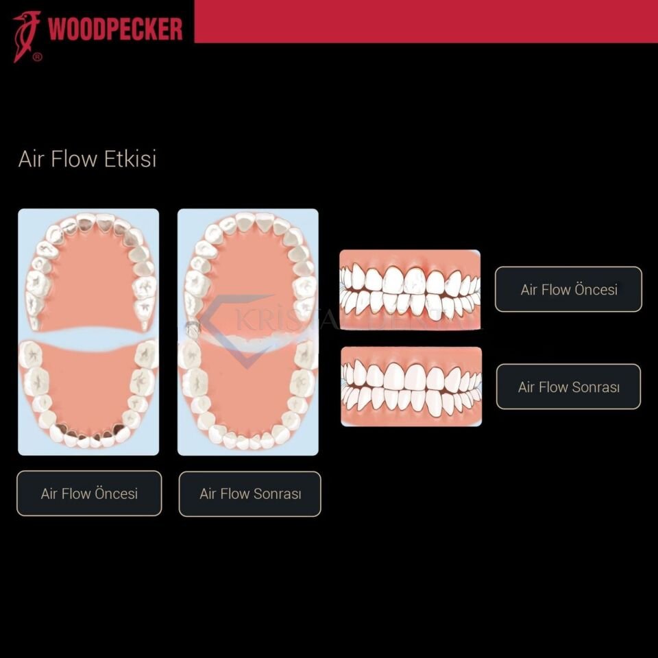 Woodpecker AP-H Airflow Cihazı