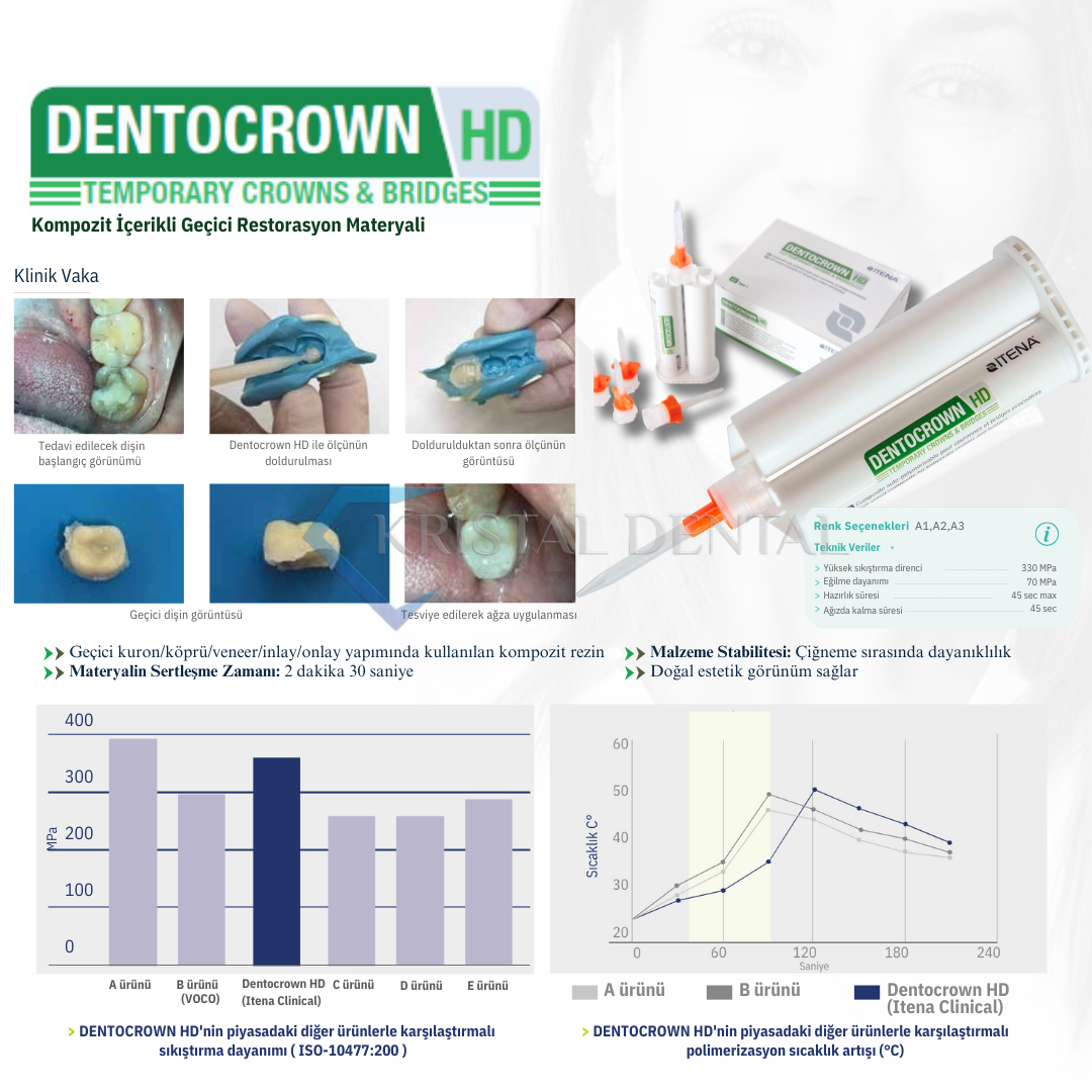 İtena Dentocrown HD Geçici Restorasyon Materyali SKT: 2026.02