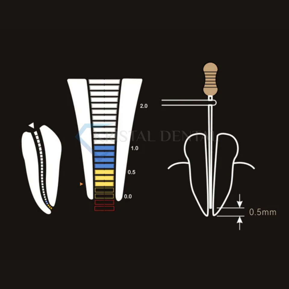 Woodpecker Dpex X Apex Locator