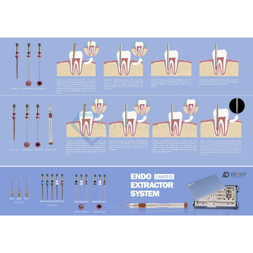 Denco E-Mate Es Endo Extractor / Kırık Eğe Çıkartıcı Sistem
