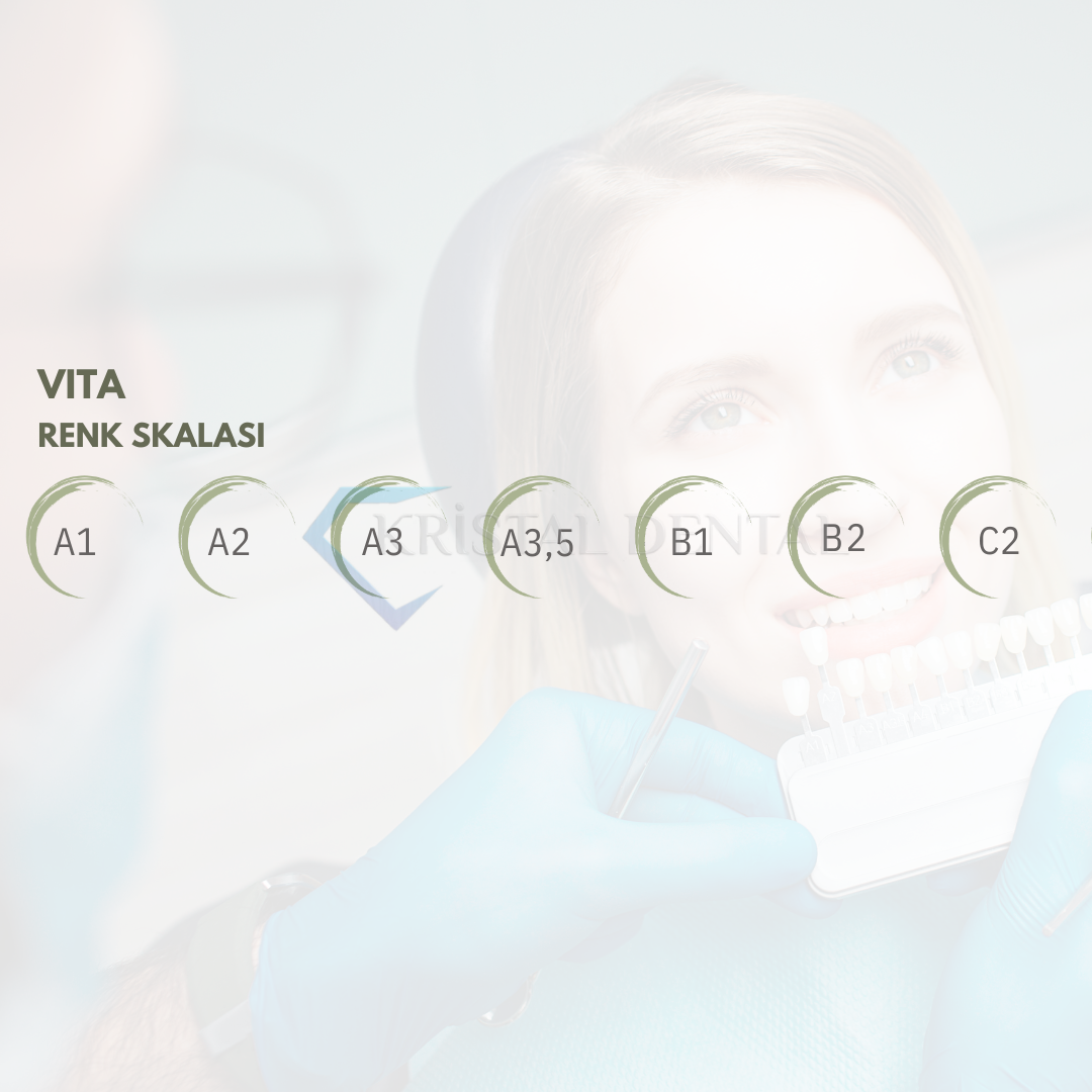Wp Dental Competence Flow Akışkan Kompozit Refil 1ml