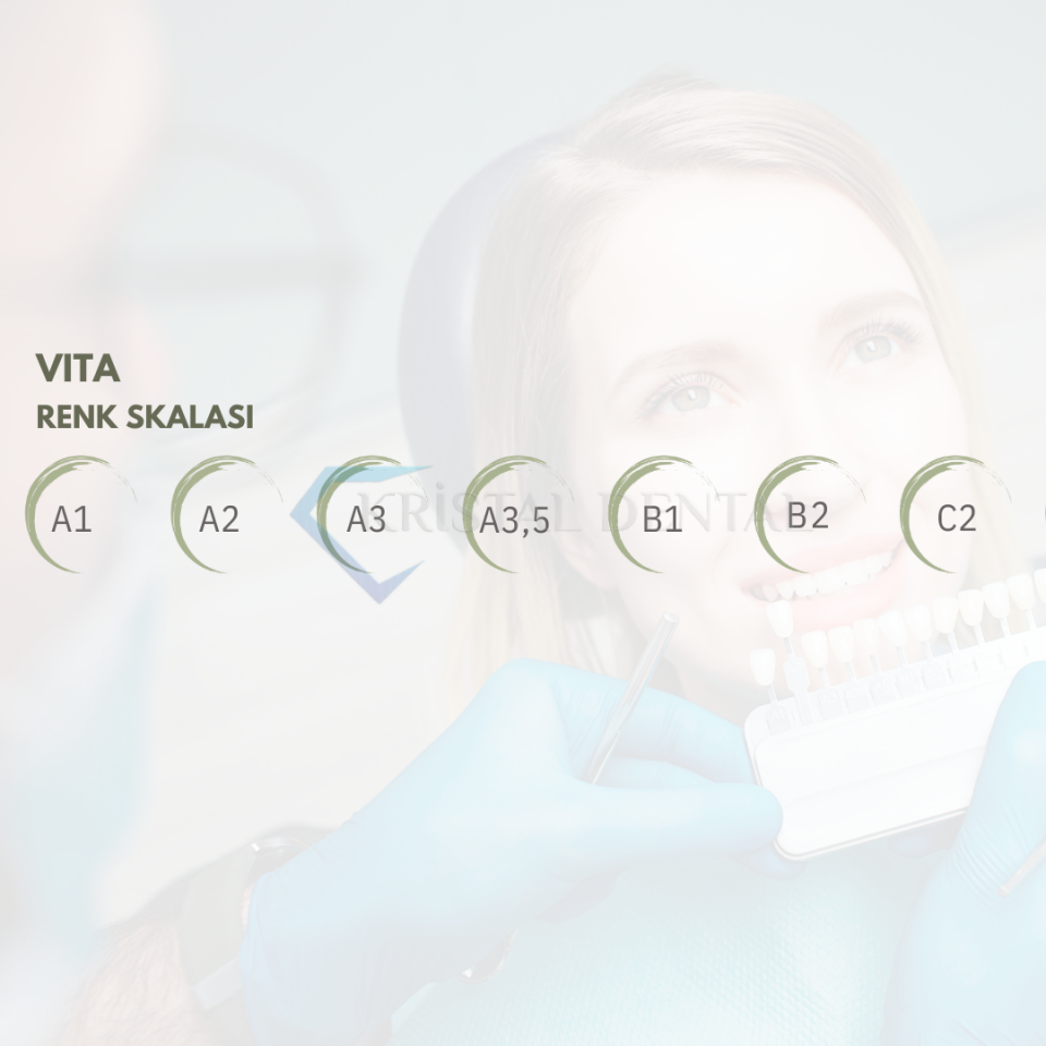 Wp Dental Competence Flow Akışkan Kompozit Refil 1ml