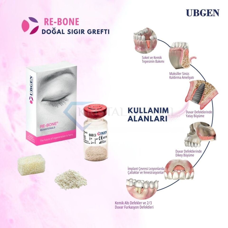 Ubgen Re-Bone Sığır Kaynaklı Toz Granül Greft