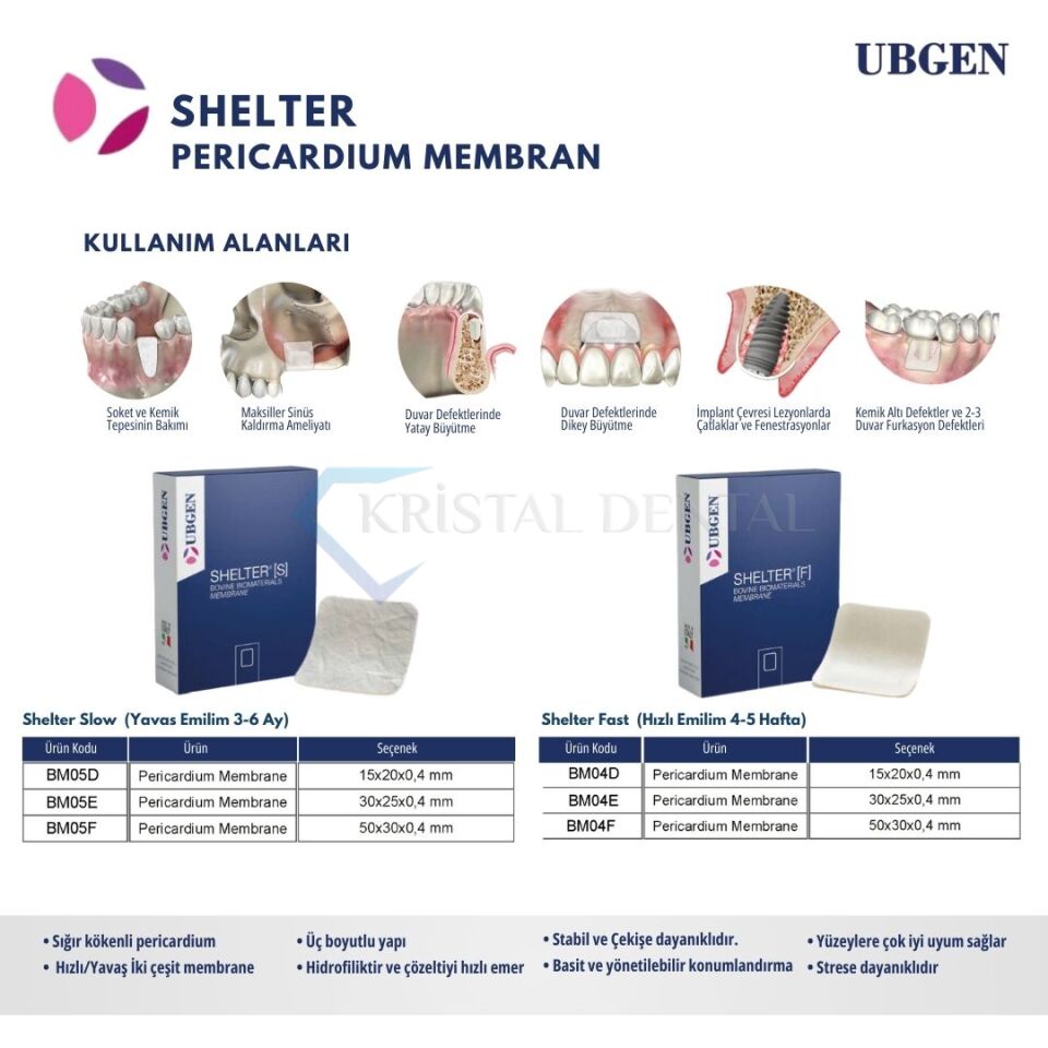 Ubgen Pericardium Shelter Fast Membran