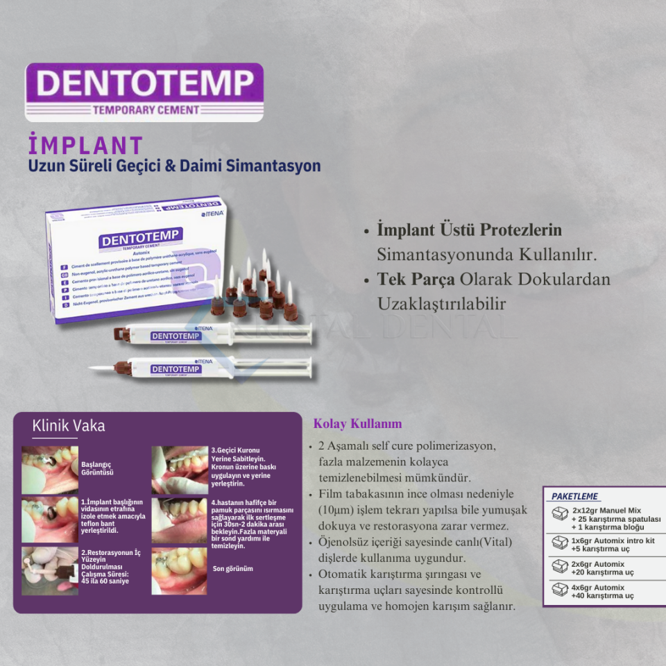 İtena Dentotemp İmplant Manuel Mix (Uzun Süreli Geçici Rezin Siman)